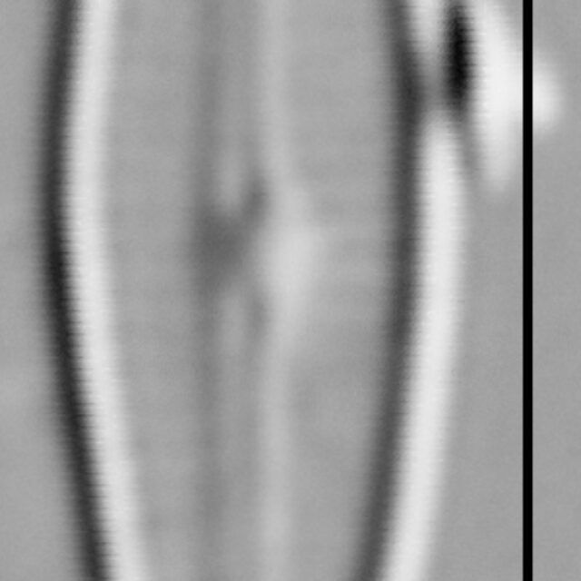 Gomphosphenia sp1 LM1