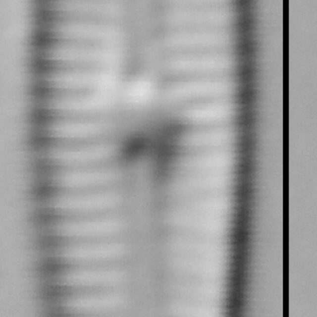 Gomphosphenia sp1 LM2