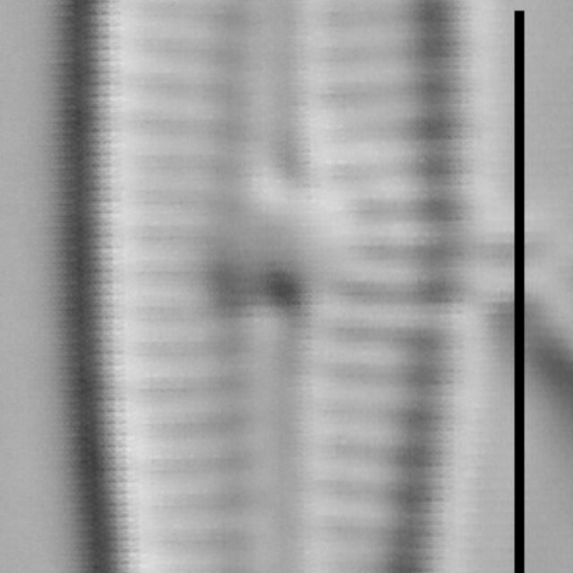 Gomphosphenia sp1 LM4