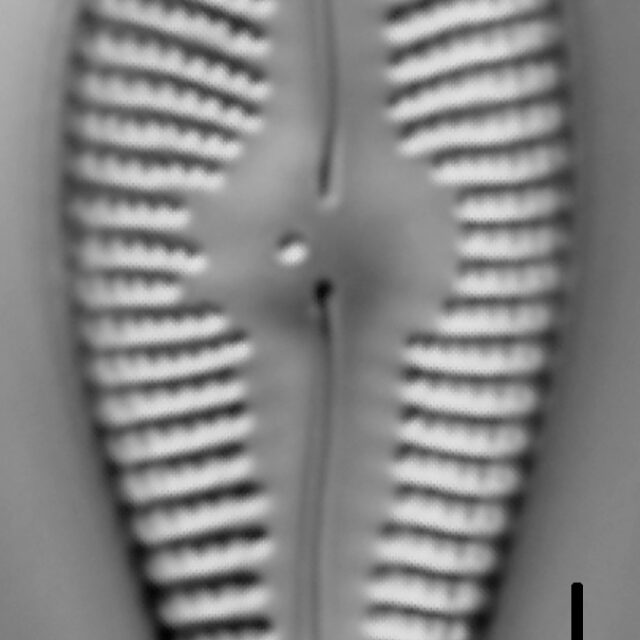 Gomphonema ventricosum LM2