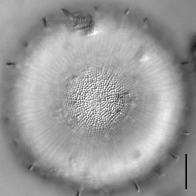 Stephanodiscus yellowstonensis LM7