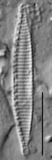 Duplicate Subacicularis 113094Arev002