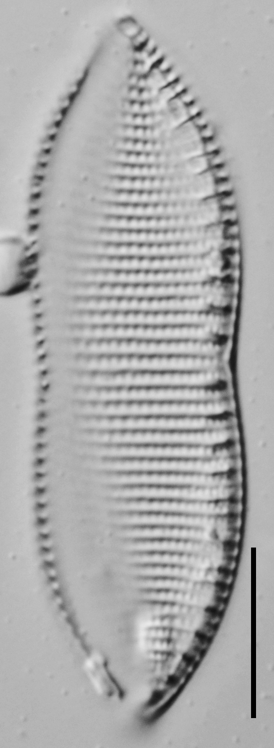 Psammodictyon constrictum LM2