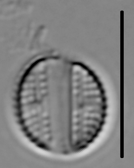 Amphora pediculus LM6