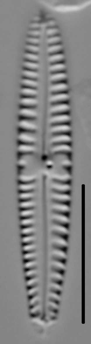 Gomphonema stoermeri LM6