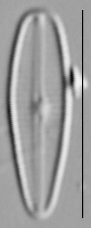 Gomphosphenia sp1 LM1