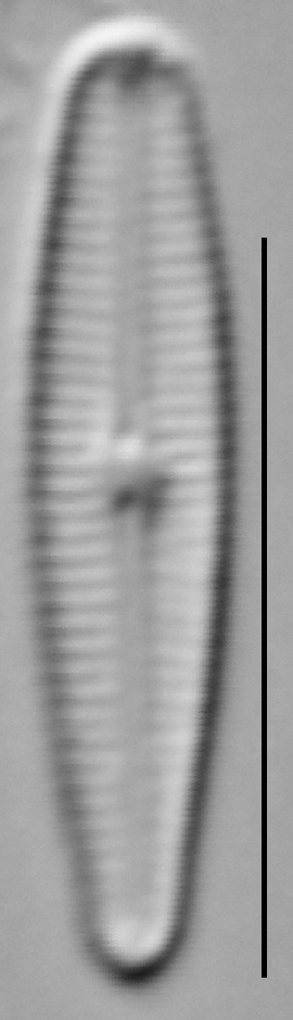 Gomphosphenia sp1 LM2