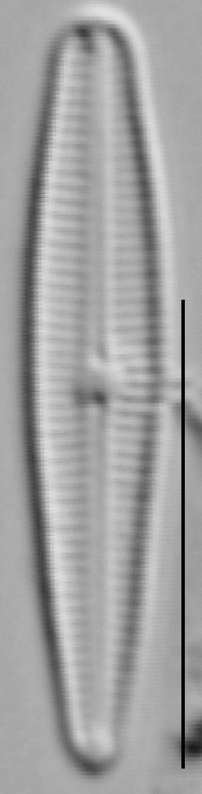 Gomphosphenia sp1 LM4