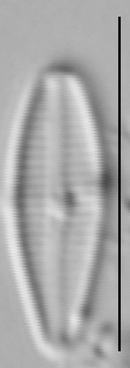 Gomphosphenia sp1 LM5