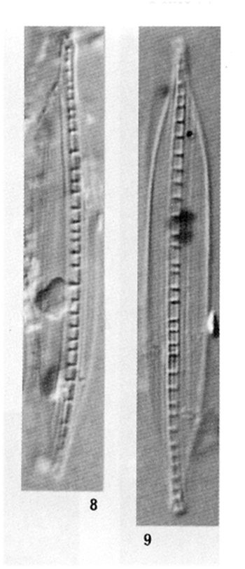 Nitzschia Dissipata Ver Borneensis 1