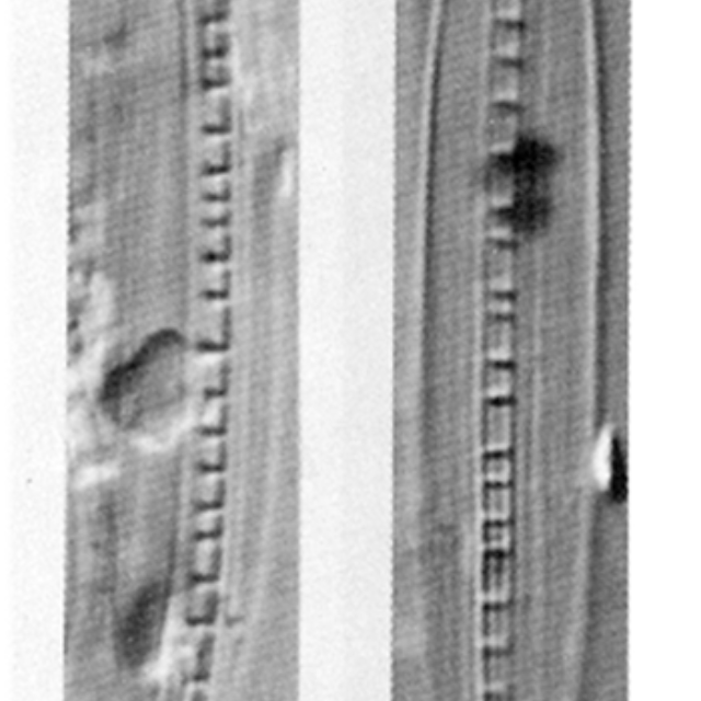 Nitzschia Dissipata Ver Borneensis 1