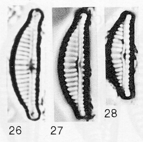 Encyonema fogedii orig illus 4