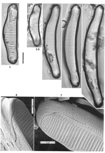 Eunotia metamonodon orig illus 2