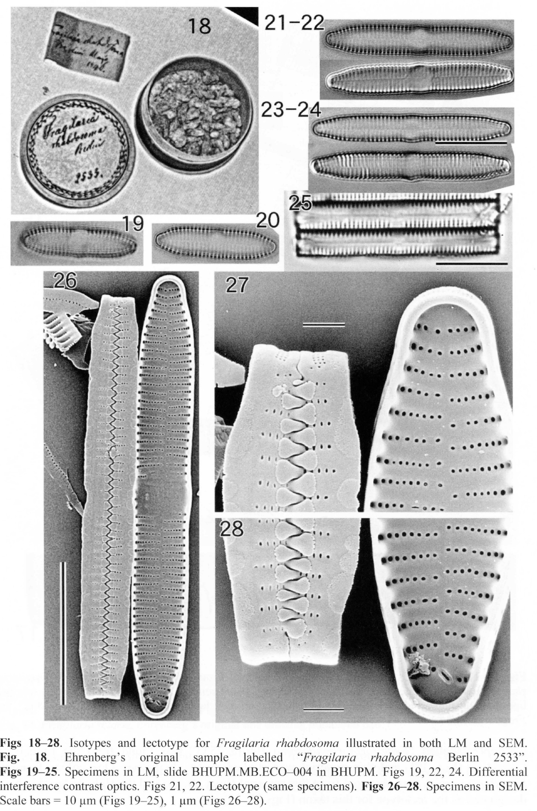Fragilaria rhabdosoma ISOTYPE
