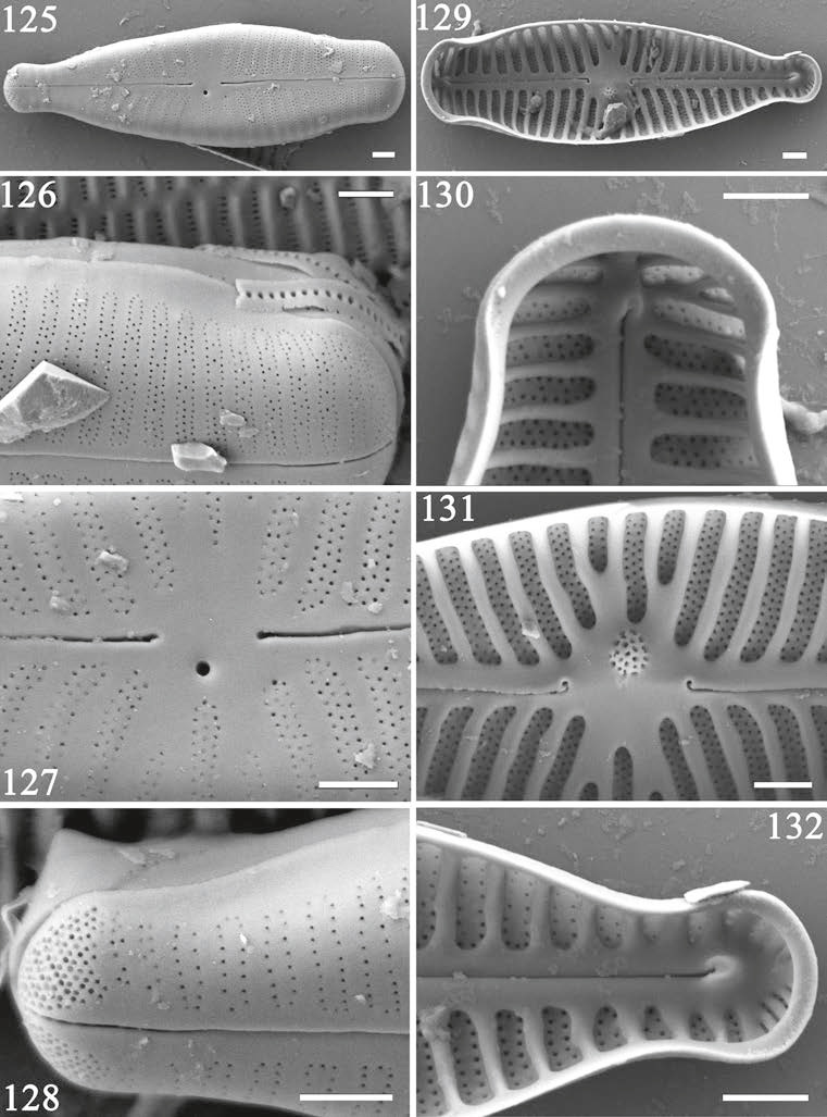 Gomphosinica Capitata  Kociolek Etal 2015 Original  Sem