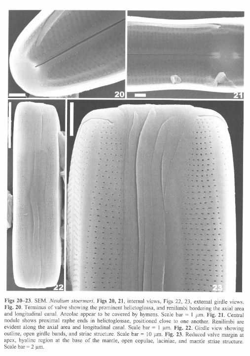 Neidium stoermeri original SEM2