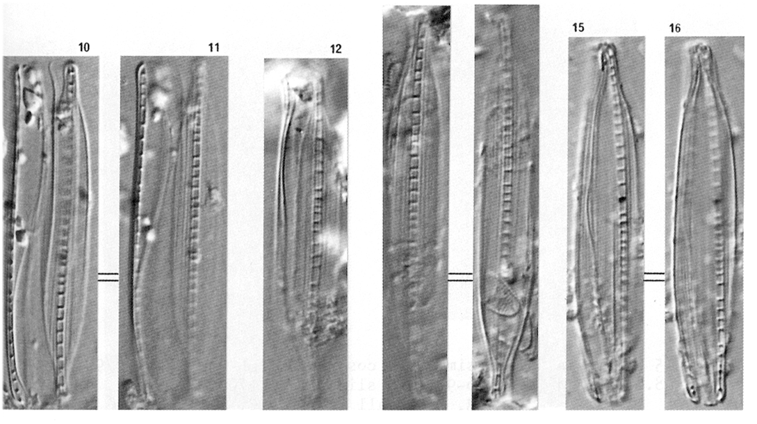 Nitzschia Dissipata Ver Borneensis 2