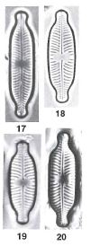 Placoneis Paraelginensis Orig Img From Type