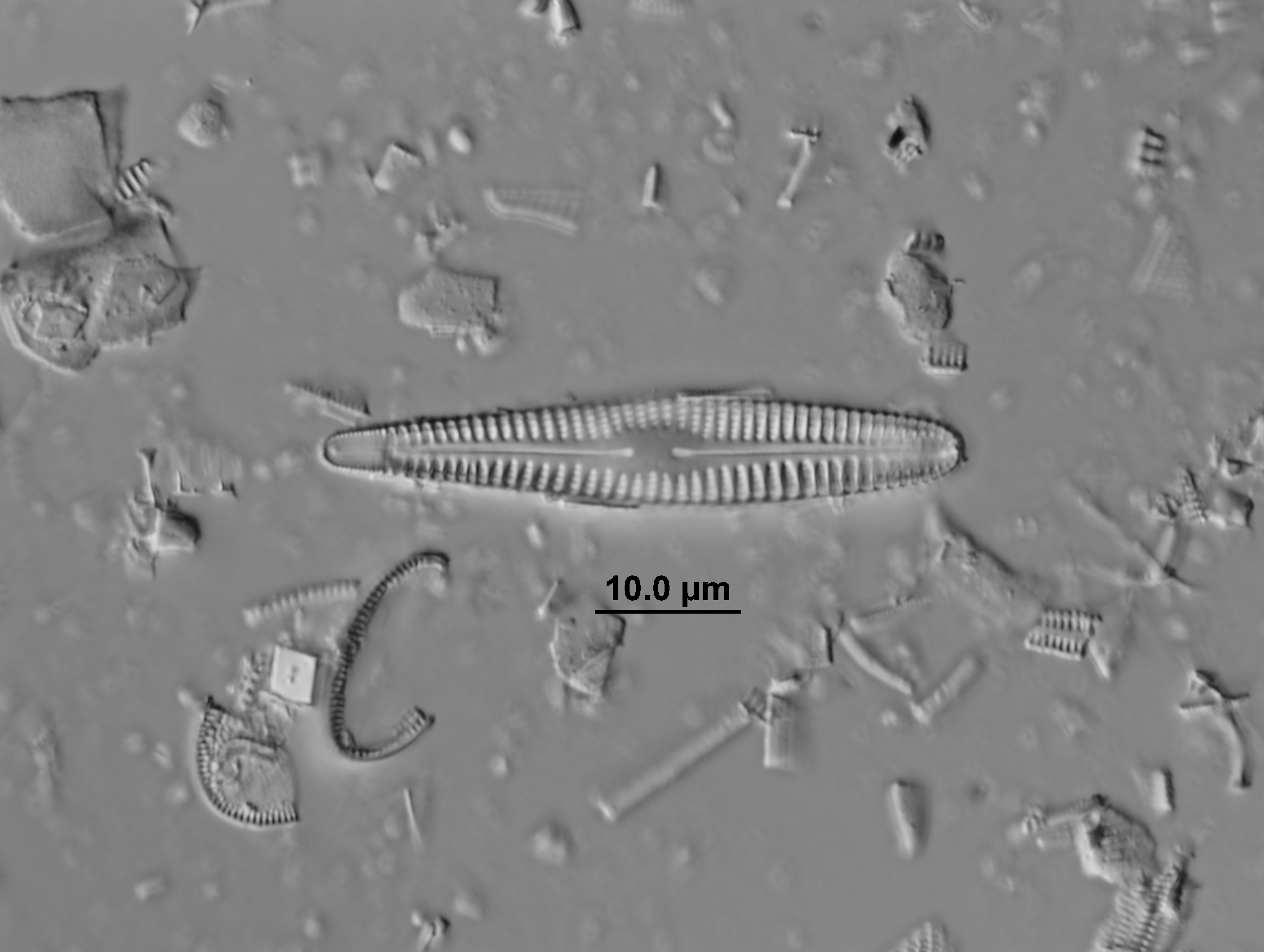 Rhoicosphenia Lowei  Holotype Image