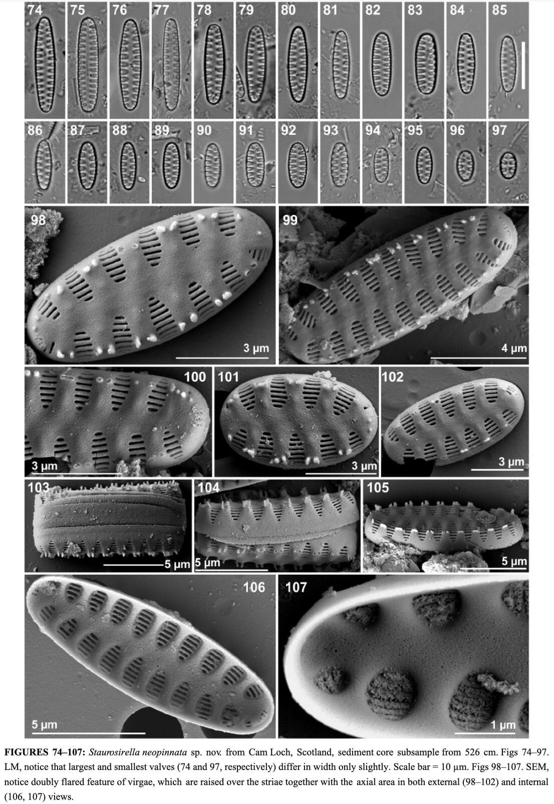 Staurosirella neopinnata illus1