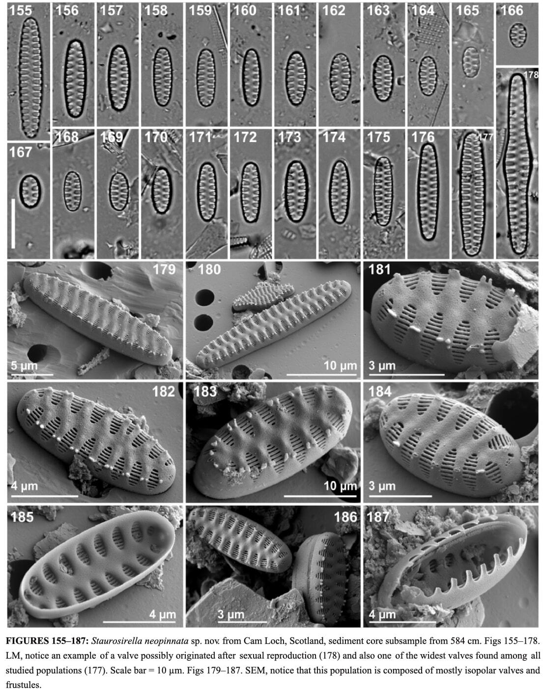 Staurosirella neopinnata illus3