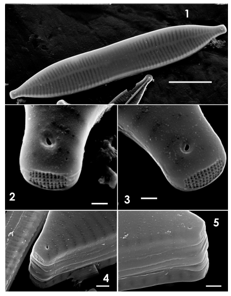 Ulnaria Rostrata Orig Desc Image2