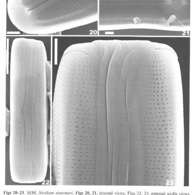 Neidium stoermeri original SEM2