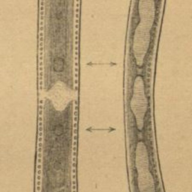 Hantzschia elongata orig ill