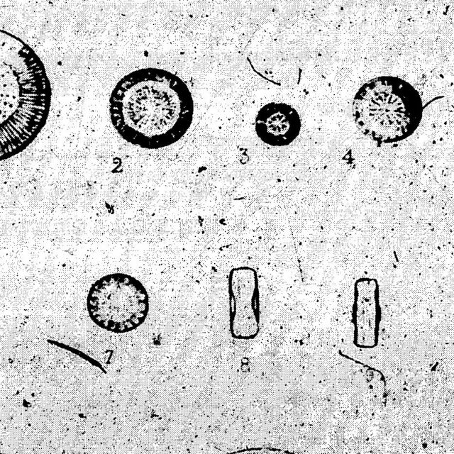 Cyclotella comta var. radiosa orig illus