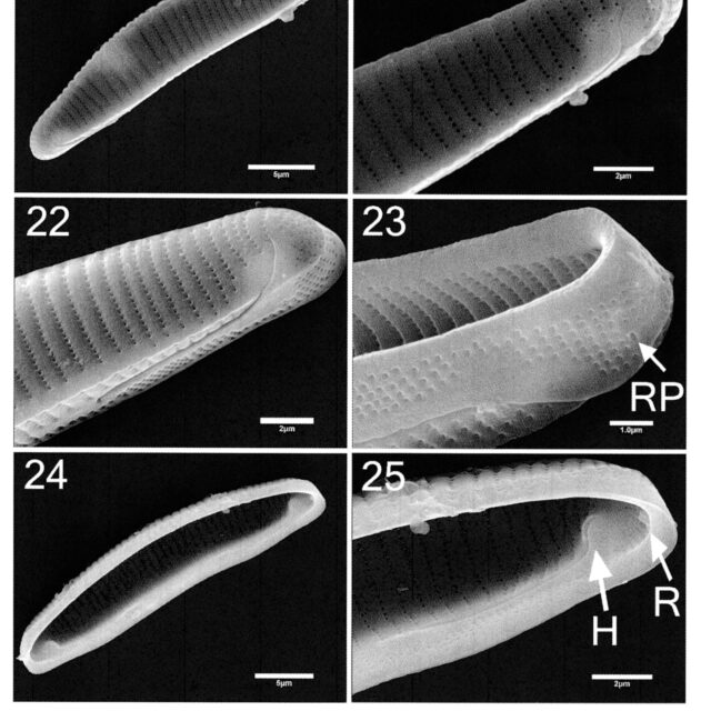 Eunotia macroglossa SEM