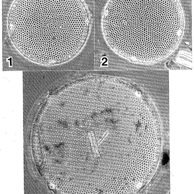 Eupodiscus radiatus LECTOTYPE