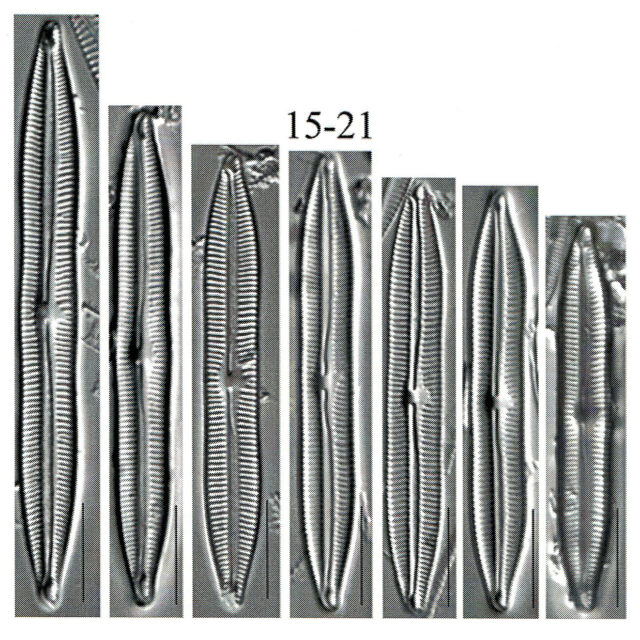 Encyonopsis lacuscaerulei orig illus