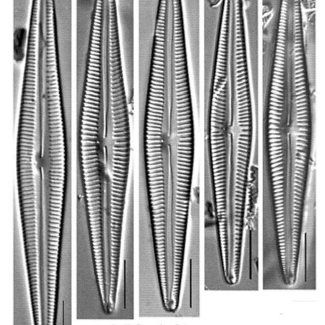 Encyonopsis lacusglacialis orig illus