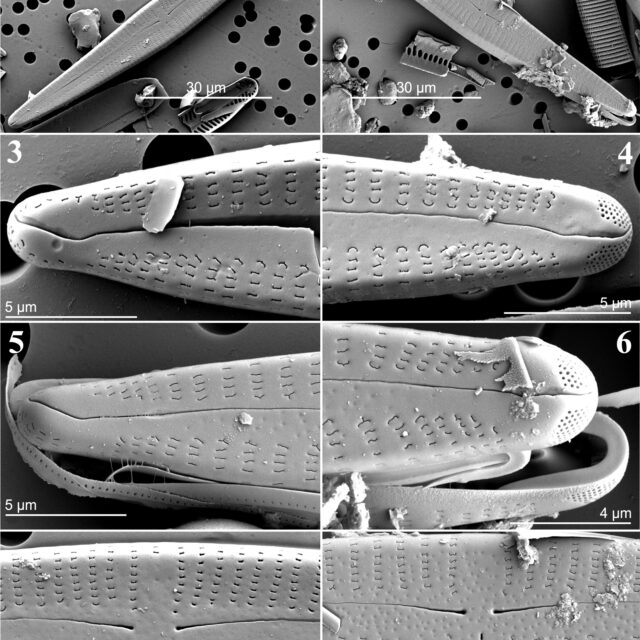 Figs1 8 Gomphonema Eileencoxiae Sem