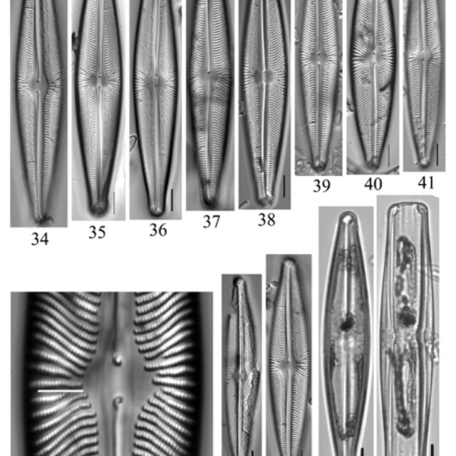 Figs34 46  Navicula Subwalkeri  Lm