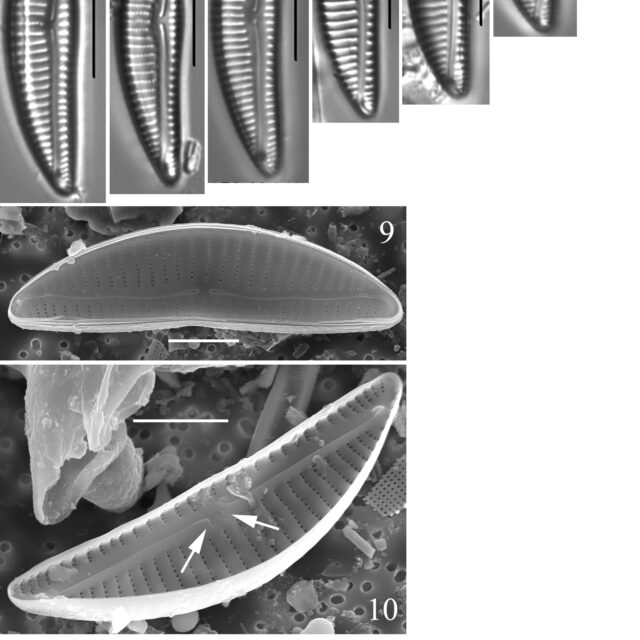 Encyonema droseraphilum orig illus