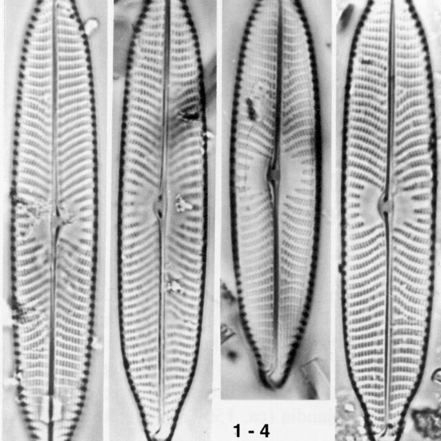 Naviridulacal Neomund