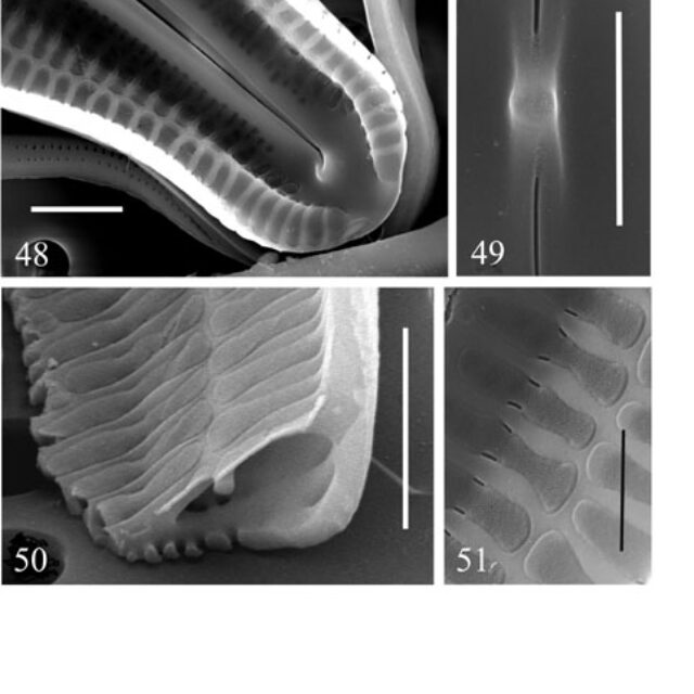 Neidiopsis  Bahls  Figures 48 51