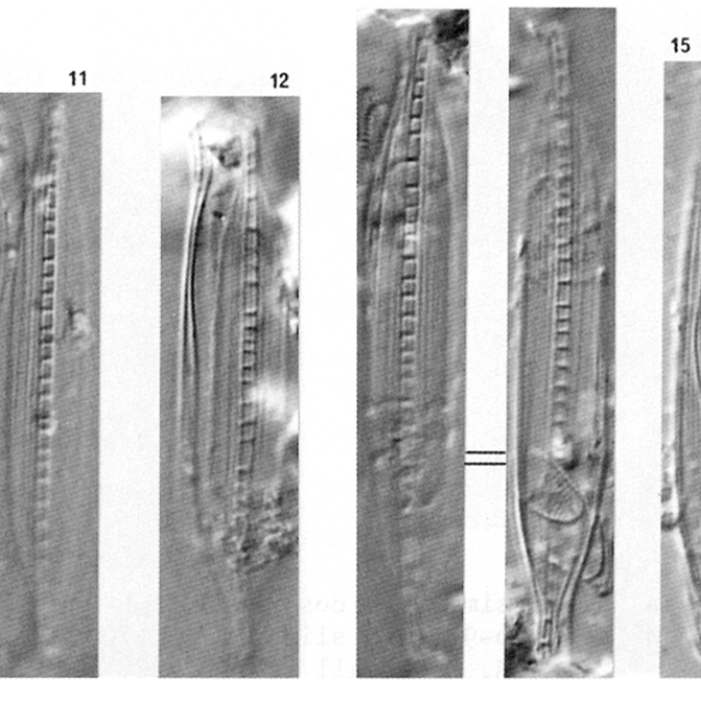 Nitzschia Dissipata Ver Borneensis 2