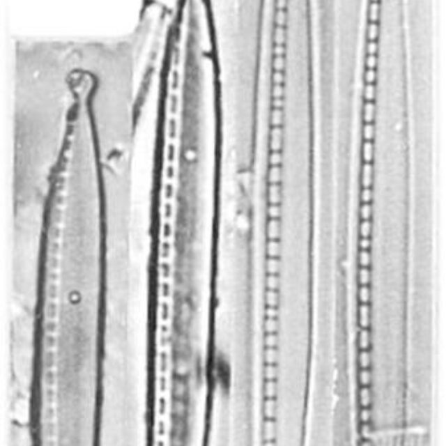 Nitzschia Dissipata Ver Oligotraphenta