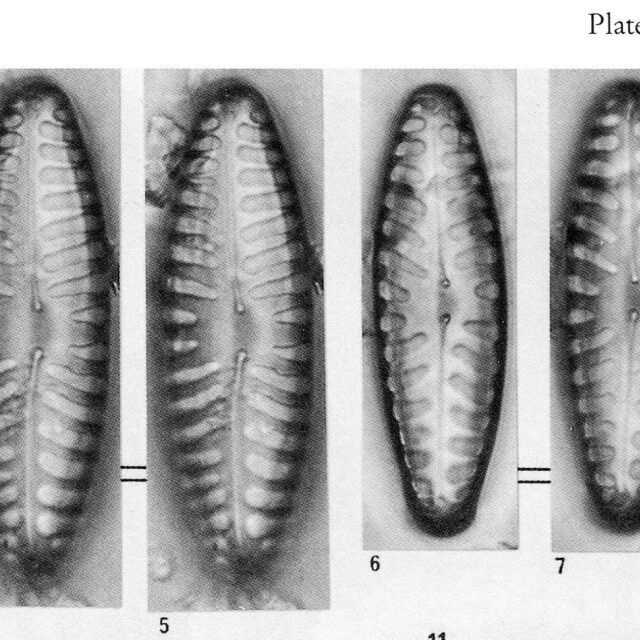 Pinnularia Borealis Lanceolata Origimag1001