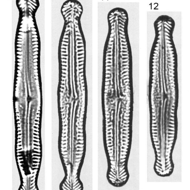 Pinnularia Nodosa Percapitata Origimag1001