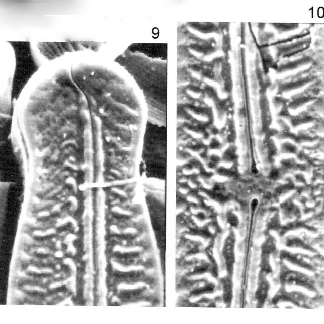 Pinnularia Nodosa Percapitata Origimag2002