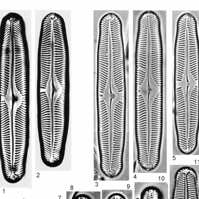 Pinnularia Rhombarea Origimag2002