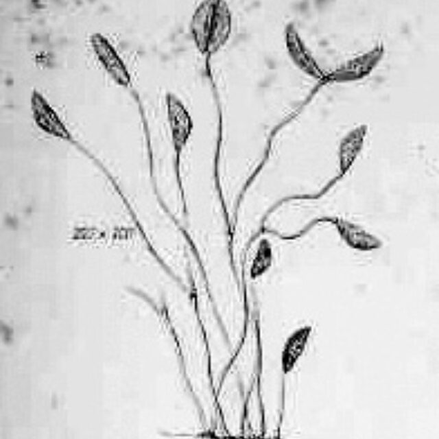 Plate Xxiv Fig 222  Cocconema Parvum  Smith1853