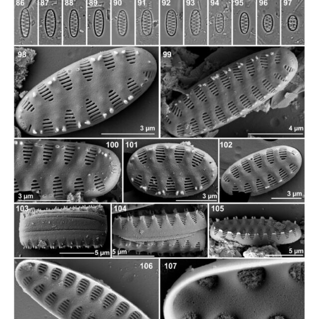 Staurosirella neopinnata illus1