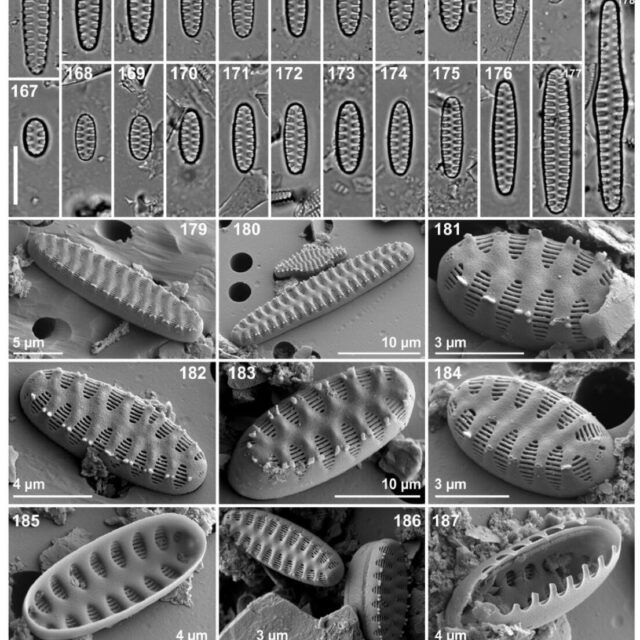 Staurosirella neopinnata illus3