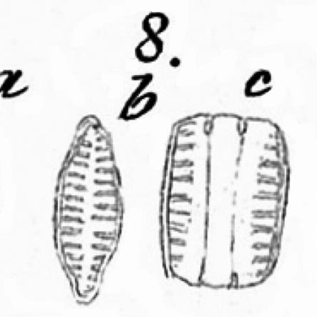 Staurosirella Leptoatauron Var Dubia Iconotype