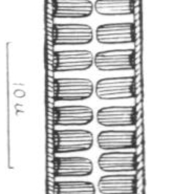 Surirella Terryi Var Arctica Orig Image  Pf1961