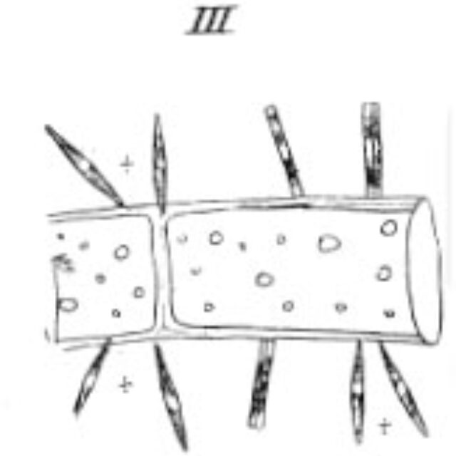 Synedra Dissipata  Kutz 1844 Drawing